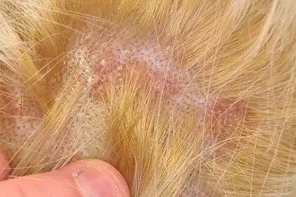 Дівчина показала фото "спаленої" шкіри голови після фарбування волосся вдома